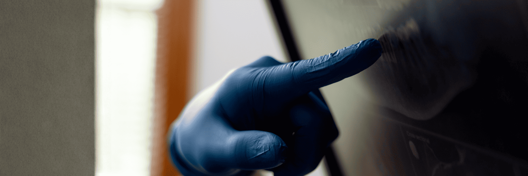 Root Canal Treatment | Dentist